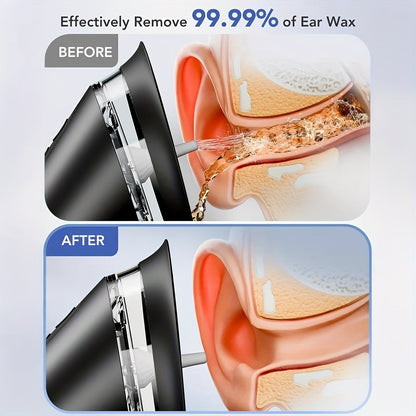 Electric Ear Wax Removal Kit 3-Speed Hydraulic Ear Cleaner with Wastewater Recovery System Safe Gentle Ear Irrigation Flushing for Adults Home Use E80 Black