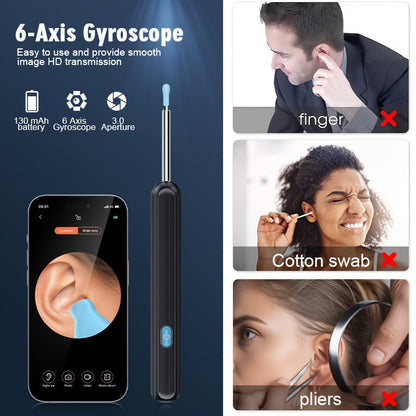 Ear Wax Removal Camera Kit 1080P HD Wi-Fi – Ear Cleaning Tool with 6 Spoons Tweezers Rechargeable Otoscope for iPhone Android Ear Care